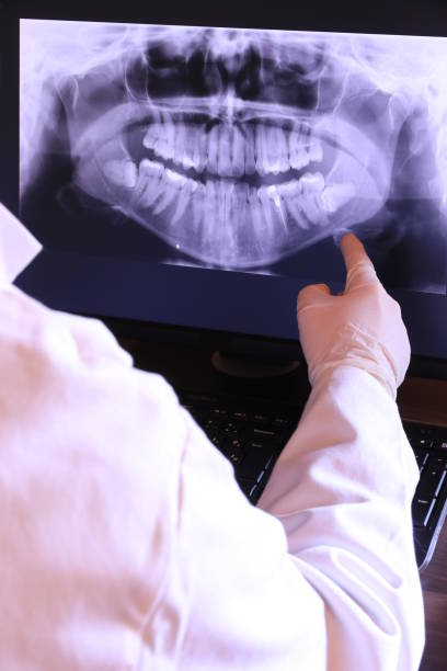 Best Broken or Cracked Tooth Emergency Dentist in Essex, IL